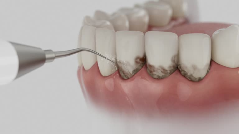 Trusted Teeth Cleaning And Checkup service in Lookout Mountain, GA - Dentist Open Now
